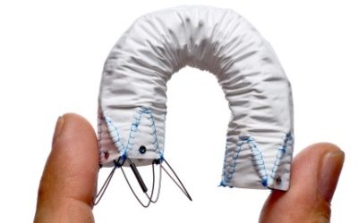 O que são Endopróteses?